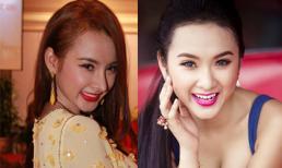 Angela Phương Trinh mất 35 triệu để nâng mũi