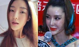 Những người đẹp phải trả giá đắt vì phẫu thuật thẩm mỹ