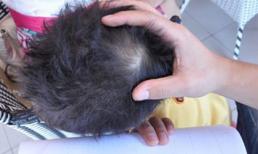 Hà Nội: Cô giáo cầm bút đâm chảy máu đầu học sinh