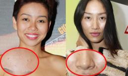 Những làn da 'lởm chởm' mụn, nám của mỹ nhân Việt (P2)