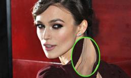 Bông hồng Anh lộ lưng trần 'mốc loang lổ'?