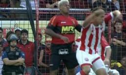 Marcelinho chi 1.000 USD để tìm lại răng