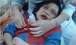 Quảng Ngãi: Bé gái 9 tuổi bị cha mẹ nuôi bạo hành dã man