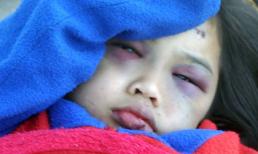 Bé gái bị hành hạ từng được rao bán 50 triệu đồng