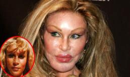 Phát hoảng với những khuôn mặt biến dạng vì thẩm mỹ của sao