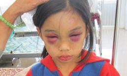 Cha nuôi bịa chuyện "cứu" bé 10 tuổi