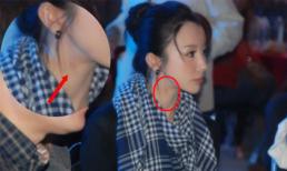 Sao Hoa ngữ và những vết bầm nghi "do yêu quá nồng nhiệt"