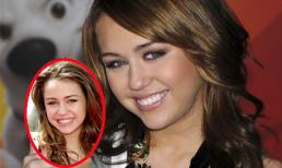 'Vạch trần' hàm răng trắng bóc của Sao