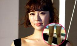 'Lật tẩy' cặp chân ngắn củn và đen của Yoon Eun Hye 