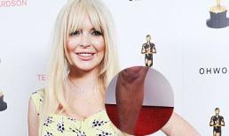 Lilo để lộ làn da loang lổ như nấm mốc