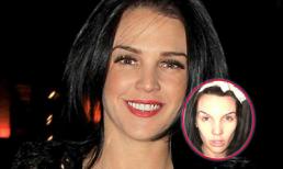 “Hoa hậu sát cầu thủ” xuống sắc thảm hại sau ca phẫu thuật ngực 