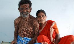 Sởn da gà với 'người bong bóng'