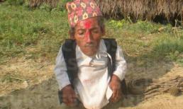 Kỷ lục người lùn nhất thế giới sắp bị phá vỡ