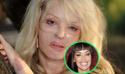 Người mẫu Katie Piper "lột xác" kỳ diệu sau tạt axit