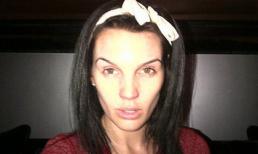 Cựu hoa hậu tiều tụy vì "xì hơi" vòng 1