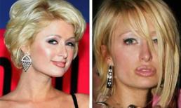 Những đôi môi phẫu thuật của Sao Hollywood