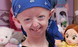 Sốc với hình ảnh cô bé 14 tuổi già như bà lão