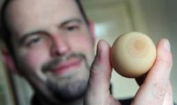 Quả trứng hình... núm vú