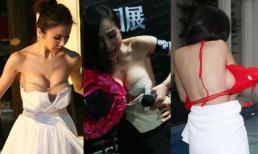 Sao và những pha bị giật tụt ngực