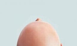 Hói đầu hơi bị hay đấy