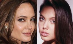 Nghi án "sửa mũi" của sao