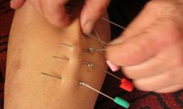 Kỳ quặc lớp học chữa bệnh "kỳ dị" bậc nhất Hà thành