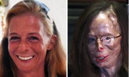 Đòi chia tay, bị người tình biến thành “quái vật”