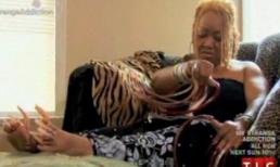 Quái dị: Nghiện nuôi móng chân