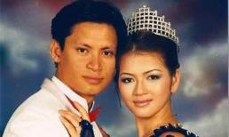 Lý Nhã Kỳ: 'Da tôi như cá sấu, cắt không chảy máu được'