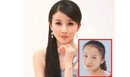 Hình ảnh sao nữ Hoa ngữ phẫu thuật thẩm mỹ