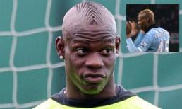 Balotelli đi điều trị “thần kinh”