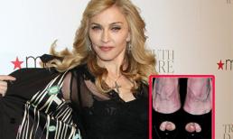 Madonna "khoe" cặp chân 'giun dế' chằng chịt