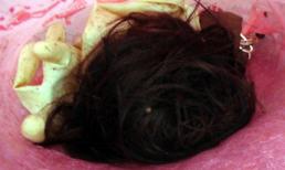 Kinh hãi những vụ đánh ghen lìa da đứt thịt