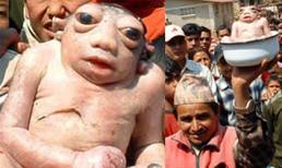 Những em bé dị dạng kỳ lạ nhất nhất thế giới