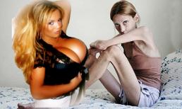 Dở khóc, dở cười những siêu mẫu lạ đời nhất thế giới