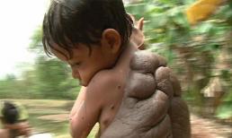 Dựng tóc gáy với cậu bé người rùa ở Nam Mỹ