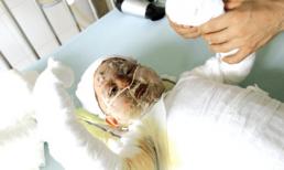 Ác nhân đốt chị dâu và cháu ruột