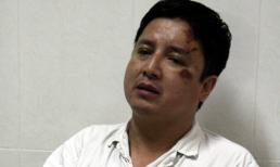 Danh hài Chí Trung bị tai nạn giao thông gãy 5 xương sườn