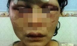 Kinh hoàng những cuộc chạy trốn khỏi gã nhân tình tàn độc