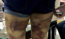 Sốc với hình ảnh cô gái bị bố mẹ đánh dã man