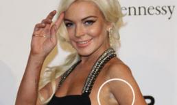 Sao xấu tệ với làn da loang lổ