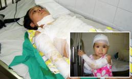 Hai mẹ con bị tạt axit: Đau đớn tột cùng