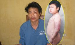 Hà Nội: Bé gái 10 tuổi bị bố hành hạ như thời trung cổ