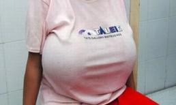 Thiếu nữ khốn khổ vì ngực khủng... 48kg