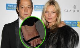 "Hoảng hốt" với bàn chân biến dạng của Kate Moss
