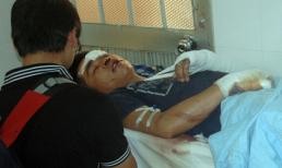 Lời kể nạn nhân vụ tai nạn kinh hoàng