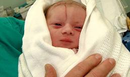 Rạch mẹ, cắt nhầm phải con và những tai nạn kinh hoàng