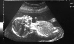 Kinh hoàng bác sĩ vứt xác thai nhi cho chó ăn