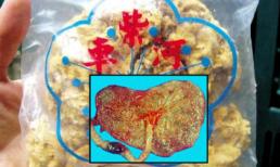 Sử dụng "thuốc thịt người": Công dụng chưa thấy, nguy cơ lây bệnh truyền nhiễm đã rõ