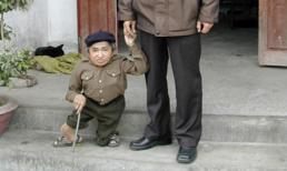 Chuyện về người lùn nhất Việt Nam